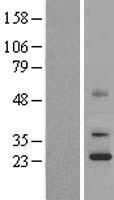 UQCC (UQCC1) Human Over-expression Lysate