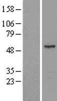 Septin 11 (SEPT11) Human Over-expression Lysate