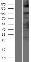 ASXL2 Human Over-expression Lysate