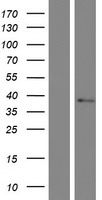 TMEM19 Human Over-expression Lysate