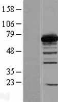 PGM2 Human Over-expression Lysate