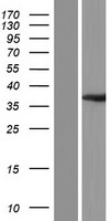 OLAH Human Over-expression Lysate