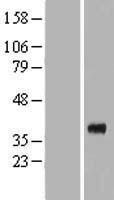 Renalase (RNLS) Human Over-expression Lysate
