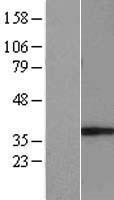 GIMAP5 Human Over-expression Lysate