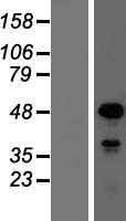 SOX18 Human Over-expression Lysate