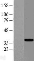EAF2 Human Over-expression Lysate