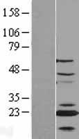 CENPN Human Over-expression Lysate