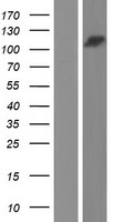 UBAP2 Human Over-expression Lysate
