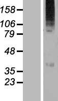 WSB2 Human Over-expression Lysate