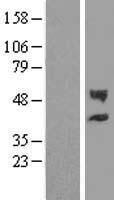 CHST12 Human Over-expression Lysate
