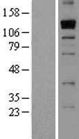 THSD1 Human Over-expression Lysate