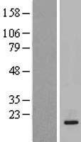 IL20 Human Over-expression Lysate