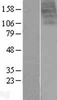 GPR14 (UTS2R) Human Over-expression Lysate