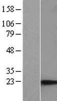 SPACA9 Human Over-expression Lysate