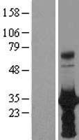 HOXB6 Human Over-expression Lysate