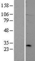 TREM2 Human Over-expression Lysate