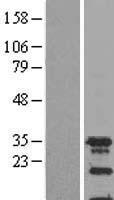 SPIN2A Human Over-expression Lysate