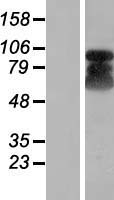 ETAA1 Human Over-expression Lysate