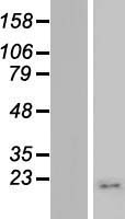 MRPS21 Human Over-expression Lysate