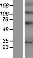 YIPF1 Human Over-expression Lysate
