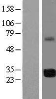 PIMREG Human Over-expression Lysate