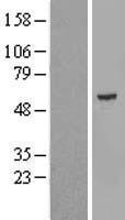 KRT24 Human Over-expression Lysate