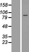 EXOC6 Human Over-expression Lysate
