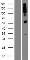 UGT1A8 Human Over-expression Lysate