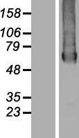 GTPBP2 Human Over-expression Lysate