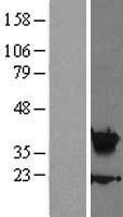 HOXA5 Human Over-expression Lysate