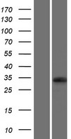 UBFD1 Human Over-expression Lysate