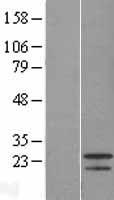 FGF21 Human Over-expression Lysate