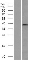 WDR45L (WDR45B) Human Over-expression Lysate