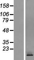 CRTAM Human Over-expression Lysate