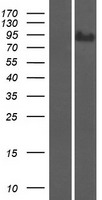 SUSD2 Human Over-expression Lysate