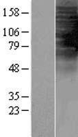 TAS2R1 Human Over-expression Lysate
