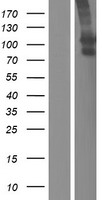 SLCO1B3 Human Over-expression Lysate