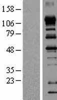 EIF4ENIF1 Human Over-expression Lysate