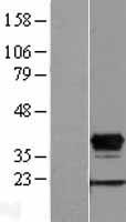 HOXD8 Human Over-expression Lysate