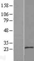 MOSPD1 Human Over-expression Lysate