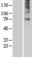 5HT7 Receptor (HTR7) Human Over-expression Lysate