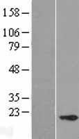CABP5 Human Over-expression Lysate