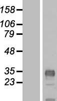 CLDND1 Human Over-expression Lysate