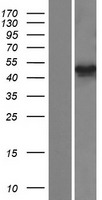TUBB4Q (TUBB7P) Human Over-expression Lysate
