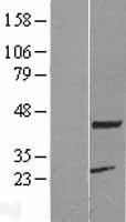 PCMF (KCMF1) Human Over-expression Lysate
