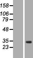 ACRV1 Human Over-expression Lysate