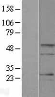 BARHL2 Human Over-expression Lysate