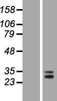 ACRV1 Human Over-expression Lysate