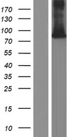WHIP (WRNIP1) Human Over-expression Lysate