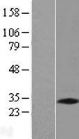 PNO1 Human Over-expression Lysate